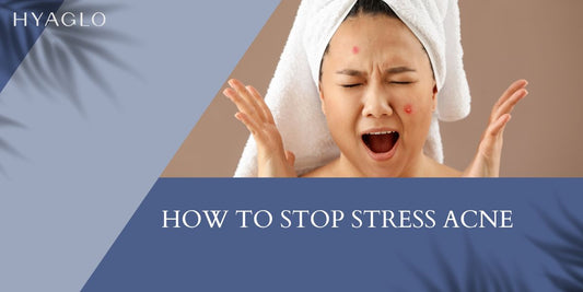 How To Stop Stress Acne